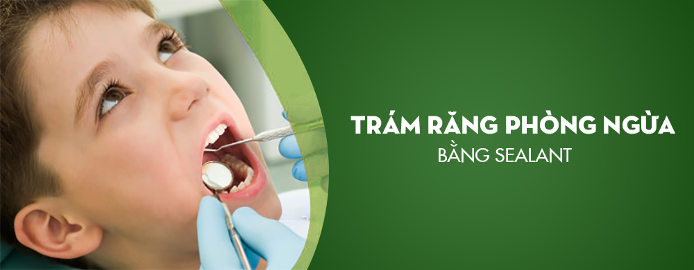 Phương pháp trám sealant 
